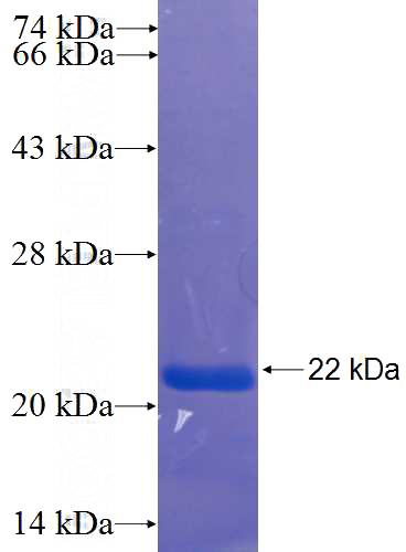Recombinant Human GMIP SDS-PAGE