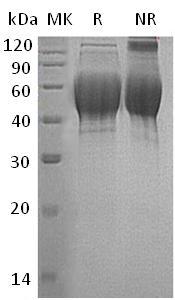 Human TXNDC15/C5orf14/UNQ335/PRO534 (His tag) recombinant protein