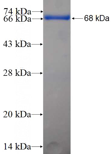 Recombinant Human PPME1 SDS-PAGE