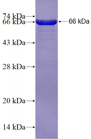 Recombinant Human USP37 SDS-PAGE