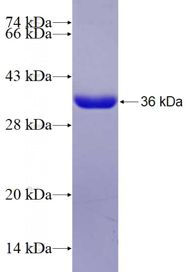 Recombinant Human PPA1 SDS-PAGE