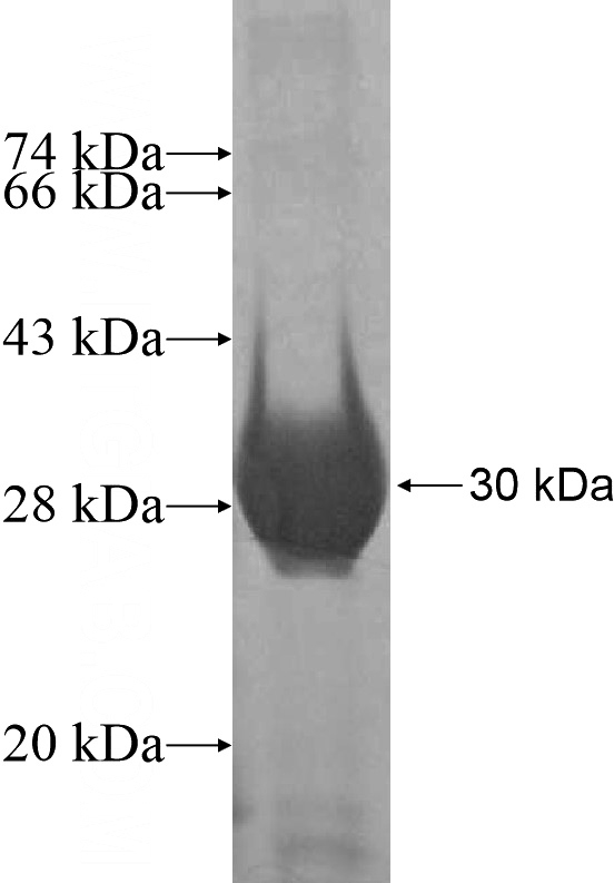 Recombinant Human RAB5A SDS-PAGE