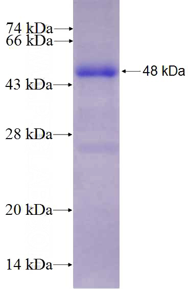 Recombinant Human RWDD2B SDS-PAGE