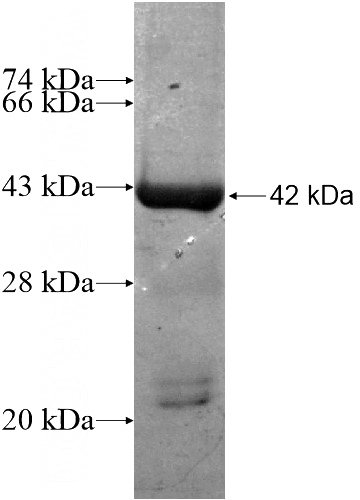 Recombinant Human AASDH SDS-PAGE