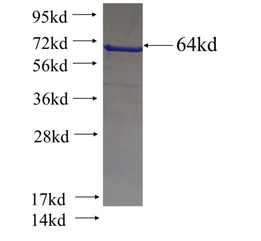 Recombinant human PIK3C2B SDS-PAGE