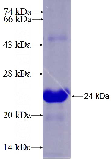 Recombinant Human GEM SDS-PAGE