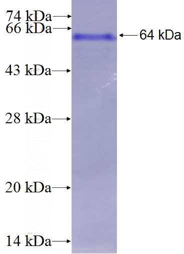 Recombinant Human RIN3 SDS-PAGE