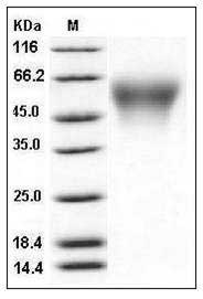 Mouse CES5 / Carboxylesterase-5 Protein (His Tag) SDS-PAGE