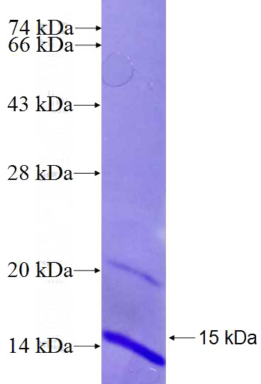 Recombinant Human BSCL2 SDS-PAGE
