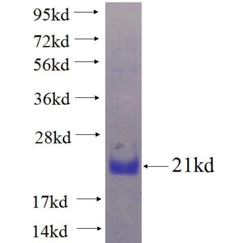 Recombinant human TAS1R1 SDS-PAGE