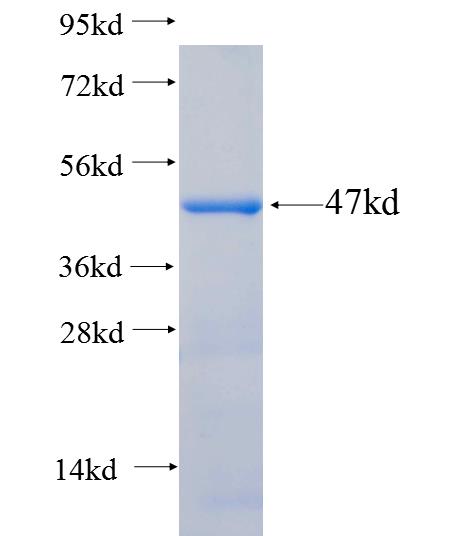 Recombinant human SERCA2,ATP2A2 SDS-PAGE