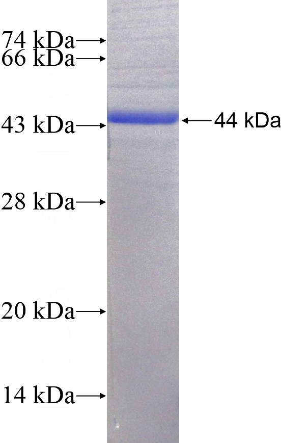 Recombinant Human Integrin alpha-9 SDS-PAGE
