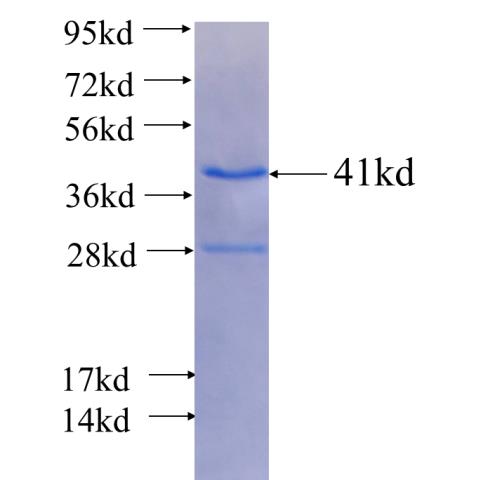 Recombinant Arabidopsis thaliana REM39 SDS-PAGE