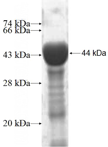 Recombinant Human MYO7B SDS-PAGE