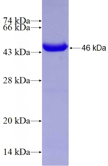 Recombinant Human RARB SDS-PAGE