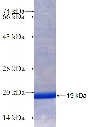 Recombinant Human SFXN3 SDS-PAGE