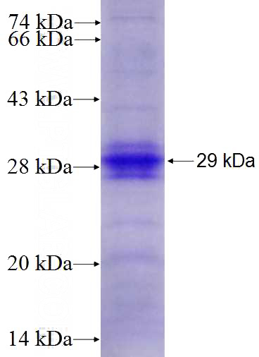 Recombinant Human Fascin SDS-PAGE