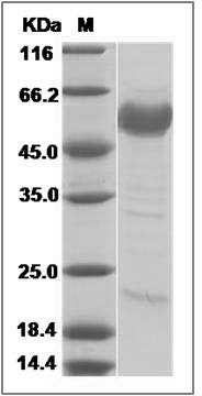 Mouse PSGL-1 / CD162 / SELPLG Protein SDS-PAGE