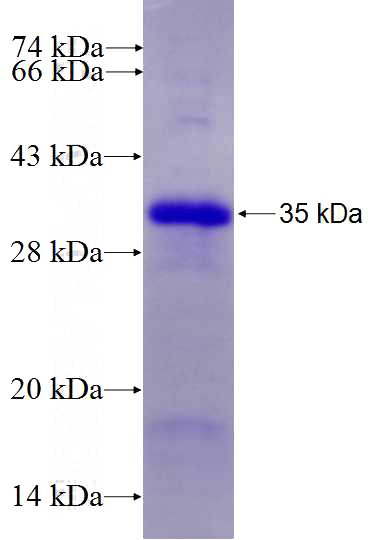Recombinant Human RPA1 SDS-PAGE