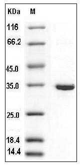 Human SULT1B1 / ST1B2 Protein (His Tag) SDS-PAGE