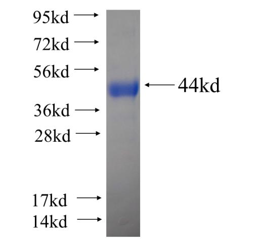 Recombinant human TCP11 SDS-PAGE