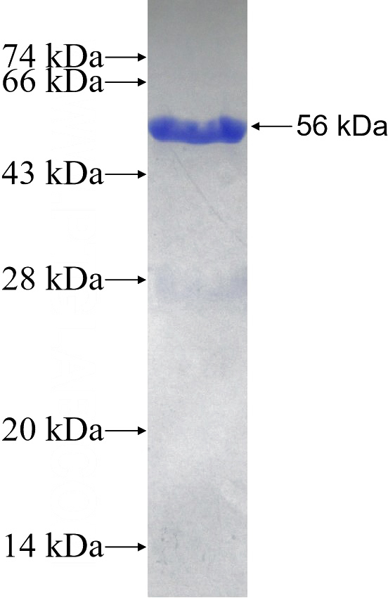 Recombinant Human NDUFS3 SDS-PAGE