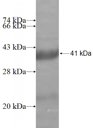 Recombinant Human CHFR SDS-PAGE
