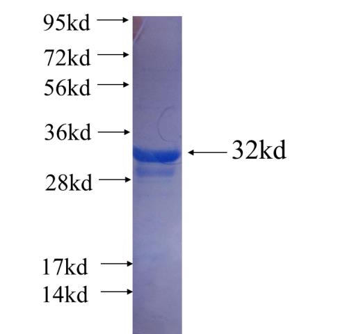 Recombinant human SYK SDS-PAGE