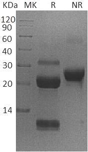 Human KLK6/PRSS18/PRSS9 (His tag) recombinant protein