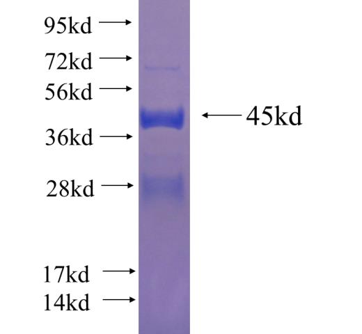 Recombinant human MYL2 SDS-PAGE