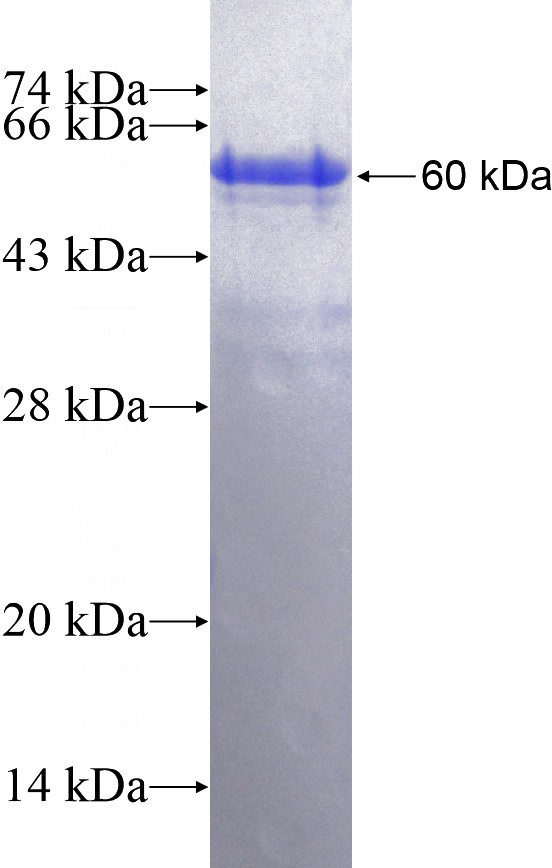 Recombinant Human CARD11 SDS-PAGE