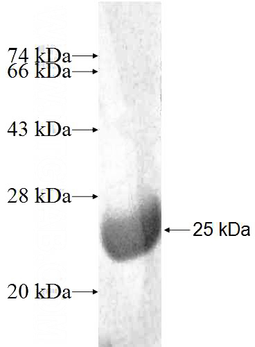 Recombinant Human RINT1 SDS-PAGE