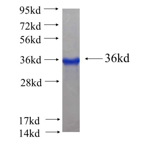 Recombinant human ZNF277 SDS-PAGE