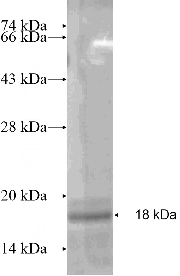 Recombinant Human GJA4 SDS-PAGE