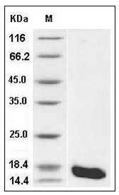 Human Cystatin S / CST4 Protein (His Tag) SDS-PAGE