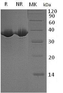 Human MDH1/MDHA (His tag) recombinant protein