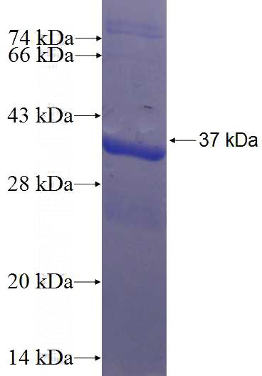 Recombinant Human BOLA2 SDS-PAGE