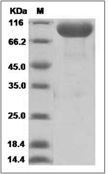 Human NCAM2 / Neural cell adhesion molecule 2 Protein (His Tag) SDS-PAGE
