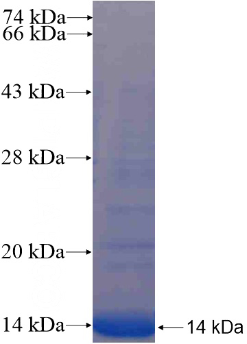 Recombinant Human BZW2 SDS-PAGE