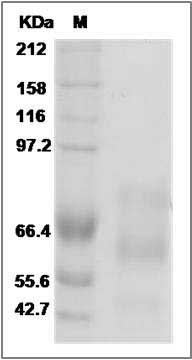 Human COL5A2 Protein (Fc Tag) SDS-PAGE