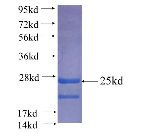 Recombinant human FOXA3 SDS-PAGE
