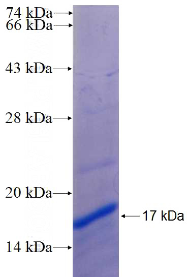 Recombinant Human SCAMP3 SDS-PAGE