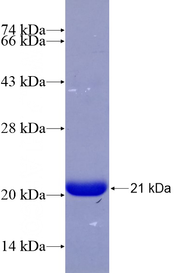 Recombinant Human PRKAR2B SDS-PAGE