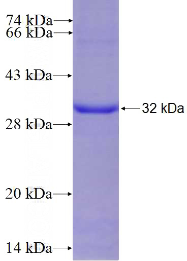 Recombinant Human DUSP15 SDS-PAGE