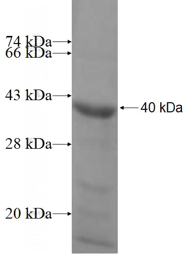 Recombinant Human UQCRC2 SDS-PAGE