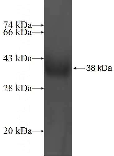 Recombinant Human POLR3K SDS-PAGE