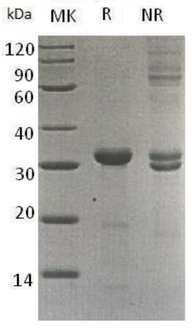Human CA10/hucep-15/UNQ533/PRO1076 (His tag) recombinant protein