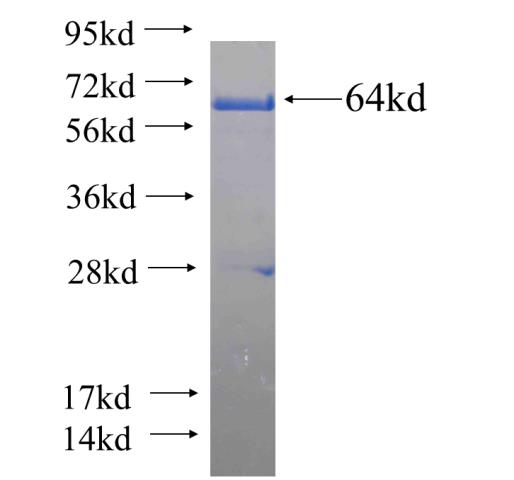 Recombinant human LONP1 SDS-PAGE