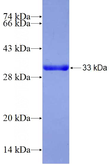 Recombinant Human SNRPG SDS-PAGE