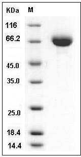 Mouse Endoglin / CD105 / ENG Protein (His Tag) SDS-PAGE